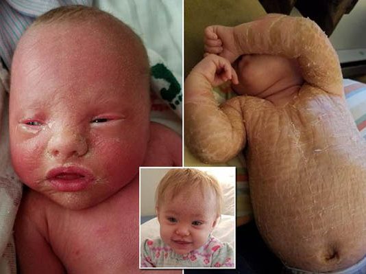 தனது ஒரு வயது மகளை பிளீச்சிங் பவுடர் போட்டு குளிக்க வைக்கும் தாய் : பரிதாப பின்னணி!!