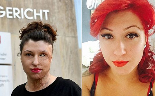 இருமுகியான அழகி : காதலனின் வெறிச்செயலின் பின் விளைவுகள்!!