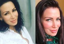 மார்பகத்தை அழகாக்க அறுவை சிகிச்சை செய்த பெண்ணுக்கு கண்விழித்தபோது காத்திருந்த அதிர்ச்சி சம்பவம்!!