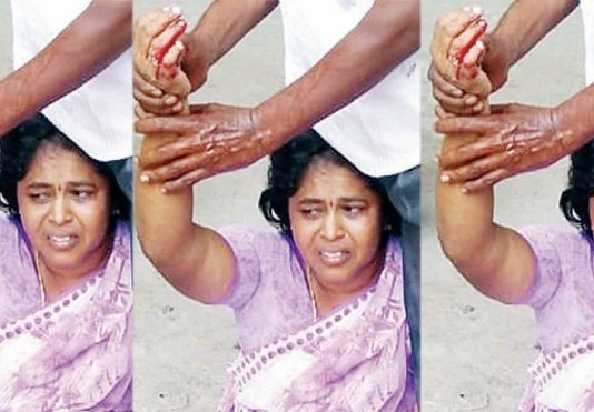 கணவனுக்கு துரோகம் செய்த மனைவி : விடாமல் துரத்தி கத்தியால் குத்திய கணவன்!!