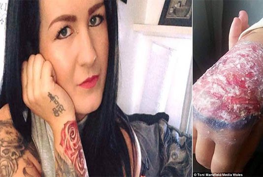 உடல் முழுவதும் பச்சை குத்திய பெண்ணுக்கு நேர்ந்த சோகம்!!