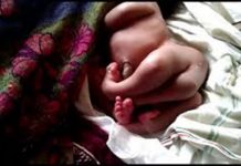 2 பிறப்புறுப்பு, நான்கு கால்களுடன் பிறந்த அதிசய குழந்தை : வைரலாகும் வீடியோ!!