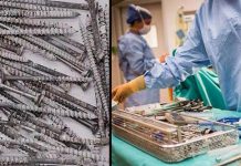 நபர் ஒருவரின் வயிற்றில் இருந்த 122 ஆணிகள் : மருத்துவர்கள் அதிர்ச்சி!!