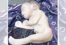 இரண்டு கால்களும் ஒட்டி வாலுடன் பிறந்த அதிசய குழந்தை!!