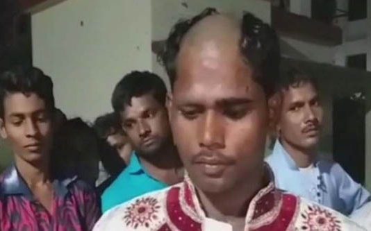 தங்க செயின் கொடுத்தால் தாலி கட்டுவேன் என கூறிய மாப்பிள்ளை : மொட்டை அடித்த மணமகள் வீட்டார்!!