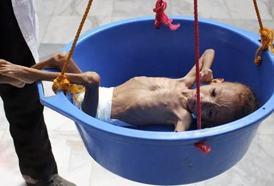 உலக நாடுகளை தலைகுனிய வைக்கும் நெஞ்சை உலுக்கும் புகைப்படங்கள்!!