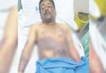 கணவன் மீது கொதிக்கும் எண்ணெயை ஊற்றிய மனைவி : அதிர்ச்சிக் காரணம்!!