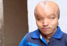 ஏலியன் என அழைக்கும் மக்கள் : காதலித்து திருமணம் செய்ய ஆசைப்படுகிறேன் என உருக்கம்!!