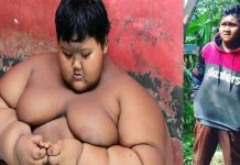 96 கிலோ உடல் எடையை குறைத்த உலகின் குண்டுச்சிறுவன் : அவரது ஆசை என்ன தெரியுமா?