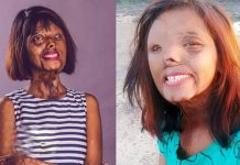 2 வயதில் மகள் மீது ஆசிட் வீசிய அப்பா : தற்போது என்ன செய்து கொண்டிருக்கிறார் தெரியுமா?