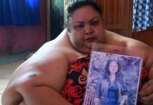 கட்டுப்பாடற்ற உணவுப் பழக்கம்.. 10 ஆண்டுகளில் ஆளே மாறிப்போன பரிதாபம்!!