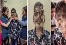 என்னை அனைவரும் கல்லை கொண்டு எறிவார்கள் : தினமும் வேதனையை அனுபவிக்கும் சிறுவன்!!