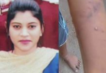 மெழுகை உருக்கி மாணவன் கையில் ஊற்றி தண்டித்த இளம் ஆசிரியை!!
