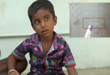 விளையாடும் போது ஆணியை விழுங்கிய 5 வயது சிறுவன் : எக்ஸ்ரே எடுத்த போது அதிர்ந்த மருத்துவர்கள்!!