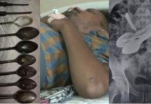 வயிற்று வலிக்காக வந்த நபர்… ஸ்கேன் ரிப்போர்ட்டில் மருத்துவர்களுக்கு காத்திருந்த அதிர்ச்சி!!