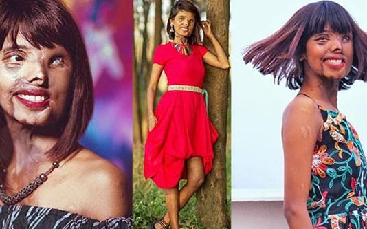 பிறந்த இரண்டே மாதத்தில் தந்தையால் ஏற்பட்ட துயரம் : மரணமடைந்த தாயார் : தனித்தே போராடிய இளம்பெண்!!