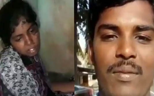 காதலியின் முகம் சிதைந்ததால் குடும்பத்துடன் தப்பி ஓடிய காதலன் : வைரலாகும் பரிதாப புகைப்படம்!!