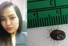 காது வலி என மருத்துவமனை சென்ற பெண்ணுக்கு காத்திருந்த அதிர்ச்சி!!