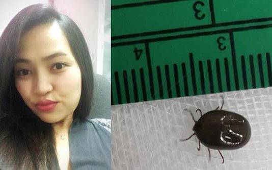 காது வலி என மருத்துவமனை சென்ற பெண்ணுக்கு காத்திருந்த அதிர்ச்சி!!