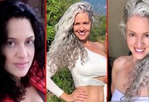 ஒரே நாளில் தலை முடி நரைத்து வயதான பெண் போல் மாறிய பெண் : நடந்தது என்ன?