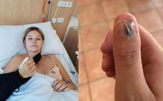 நகம் கடிக்கும் பழக்கத்தால் தோல் புற்றுநோய் பாதிப்புக்கு உள்ளான இளம்பெண்!!