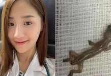 காதில் உயிருடன் இருந்த பல்லி : பெண் மருத்துவரின் வாழ்வில் மறக்க முடியாத அனுபவம் இது தானாம்!!