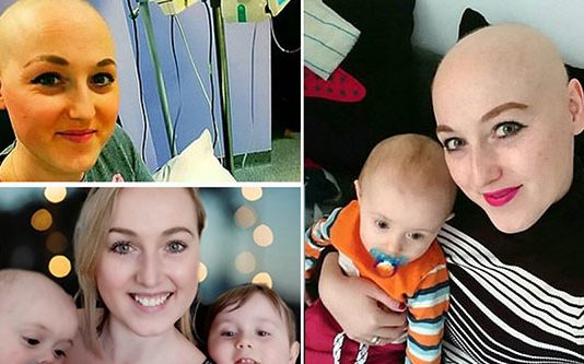 மருத்துவர்களின் தவறான முடிவால் மார்பகங்களையும் தலைமுடியையும் இழந்த இளம்பெண்!!