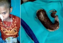 வயிற்று வலியால் துடித்த 14 வயது சிறுமி… ஸ்கேன் ரிப்போர்ட்டில் என்ன இருந்தது தெரியுமா?
