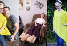 சிலை போன்று உருமாறி வரும் பெண் : விசித்திர நோயால் அவதி!!