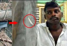 முதுகு வலி பொறுக்க முடியாமல் கதறிய இளைஞர் : எக்ஸ்ரே எடுத்து பார்த்த போது காத்திருந்த அதிர்ச்சி!!