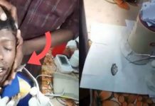 வ லியால் து டித்த சி றுவனின் மூ க்குக்குள் உ யிருள்ள மீன் குஞ்சு : வைத்தியர்கள் அ திர்ச்சி!!