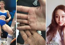 பொழுதுபோக்குக்காக ஜிம்முக்கு போன பெண் மருத்துவர் : இப்போது எப்படி இருக்கிறார் பாருங்கள்!!