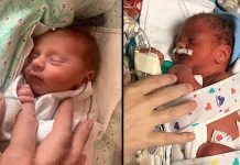 ஒரு வருட இடைவெளியில் பிறந்த இரட்டை குழந்தைகள் : ஒரு வினோத சம்பவம்!!