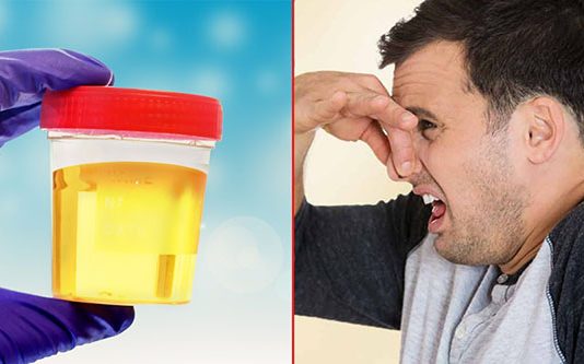 சிறுநீர் கழிக்கும் போது கடுமையான துர்நாற்றம் வீசுகின்றதா : அது இந்த நோயின் அறிகுறியாக கூட இருக்கலாமாம்!!