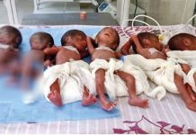 ஒரே பிரசவத்தில் 6 குழந்தைகளை பெற்றெடுத்த தாய்!!