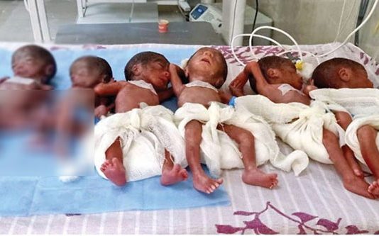 ஒரே பிரசவத்தில் 6 குழந்தைகளை பெற்றெடுத்த தாய்!!