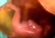 பனிக்குடத்துடன் வெளிவந்த குழந்தை : மருத்துவ உலகின் அதிசயம்! படைத்த கடவுளையும் வியக்க வைத்த அரிய காட்சி!!