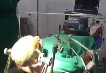 மூளை அறுவை சிகிச்சையின் போது பிக்பாஸ் பார்த்த 33 வயது இளைஞர்… வீடியோ காட்சி!!