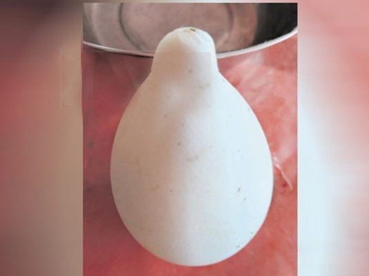 இலங்கையில் கண்டுபிடிக்கப்பட்ட விசித்திரமான கோழி முட்டை!!