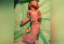 மீன் போன்று பிறந்த கு ழ ந்தை! 2 மணிநேரத்தில் உ.யி.ரிழந்த சோ கம்!