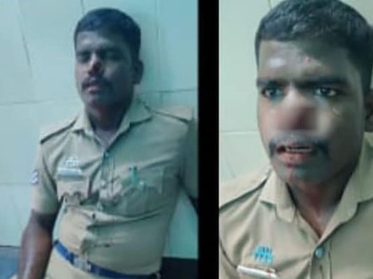 நிலத்தகராறில் போலீஸின் மூக்கை க.டித்த ராணுவ வீரர்!