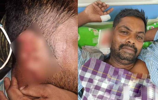 தொழிலாளியின் காதை க.டி.த்.து து.ண்.டா.க்கிய கொ.டூ.ரம்!! அ.ர.ங்கேறிய சோ.க ச.ம்.பவம்!!