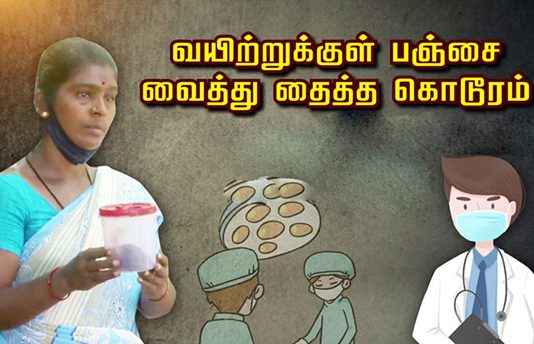 வயிற்றுக்குள் பஞ்சை வைத்து தைத்த கொடூரம் : அம்பலமான அதிர்ச்சி தகவல்!!