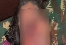 காதலியின் மூக்கை கோடாரியால் அறுத்த காதலன் : அதிர்ச்சிக் காரணம்!!