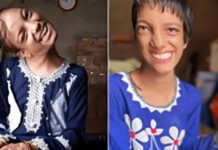 “எங்ககிட்ட அவ்வளவு காசு இல்ல சார்”.. 12 வருஷமா வேதனையுடன் தவிச்ச சிறுமி : ஒரு ரூபாய் கூட வாங்காமல் ஆப்பரேஷன் செய்த மருத்துவர்!!