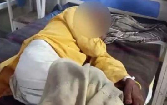 சிறுநீர் கழிக்கும் போது நிகழ்ந்த துயரம் : தனது ஆணுறுப்பை கோடாரியால் வெட்டிய நபர்!!